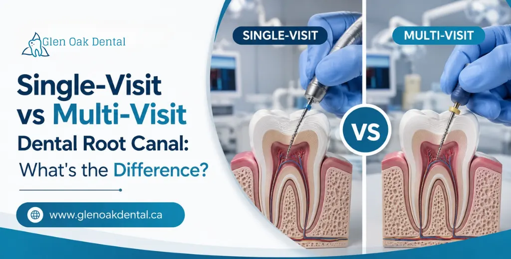Single-Visit vs Multi-Visit Dental Root Canal: What’s the Difference?